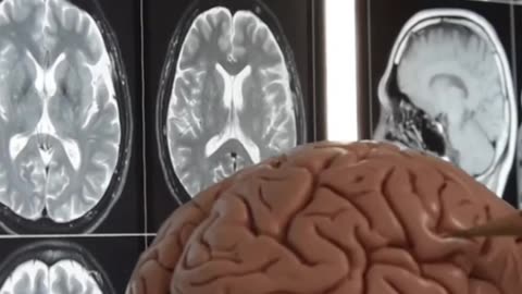 Do We Really Use Only 10% of Our Brains?