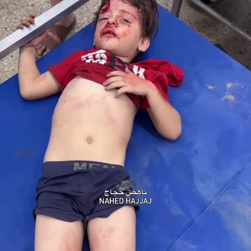 A child was injured and taken to Al-Shifa Hospital after a house was targeted