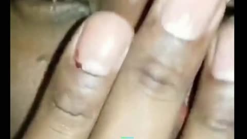 Diddy's Bloody Finger in the Sean Combs documentary 🕵️🕵️