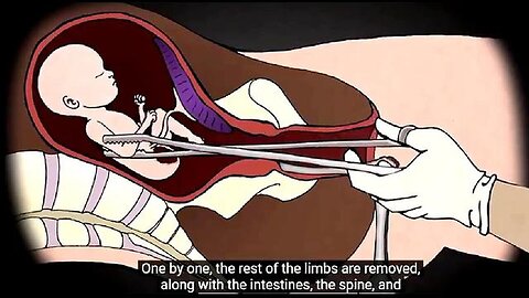 "Unveiling JFK Jr.'s Stance on Full-Term Abortion: A Compelling Insight"