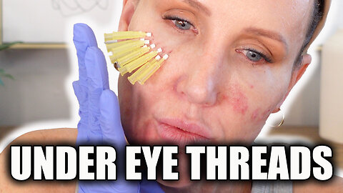 Under eye Threads - My Secret Weapon - Acecosm.com discount code STACY10