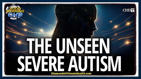 🧒 💉 The Unseen Severe Autism ⭐ 25% of Autism Cases Are Deemed “Level 3” or “Severe” on the Spectrum