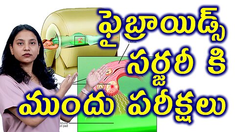 ఫైబ్రాయిడ్స్ సర్జరీ ముందు పరీక్షలుTests For Fibroids Removal Operation Myomectomy Surgery Homeopathy