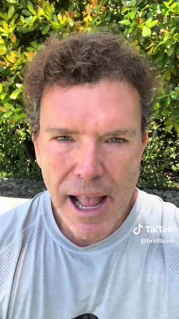 Bret Baier: His Non-Studio Hair Makes Him Look Like a Cross Between Bobby Brady and Albert Einstein