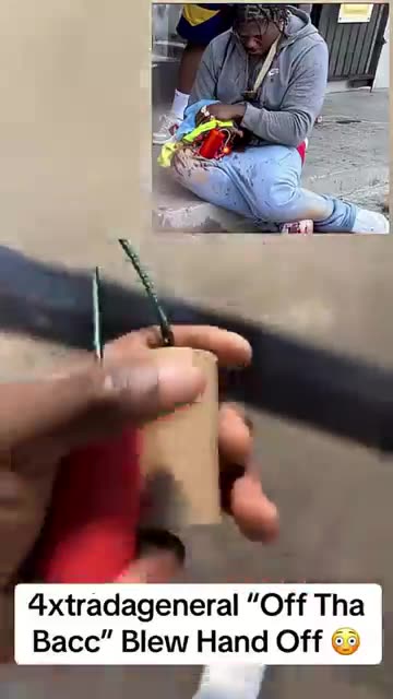YouTuber/rapper/moron blew his hand off with a firework incident