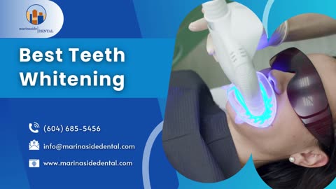 Get the Best Teeth Whitening Vancouver Has to Offer | Marinaside Dental