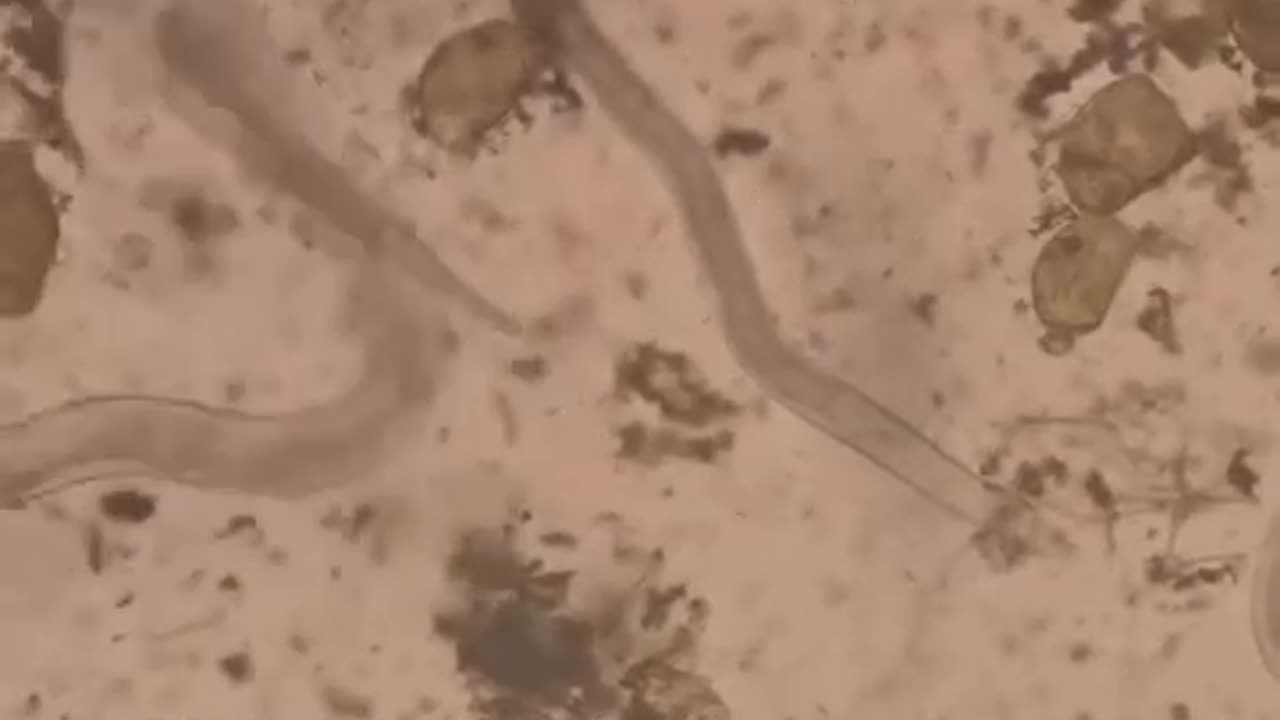 Turmeric vs human parasites under the microscope