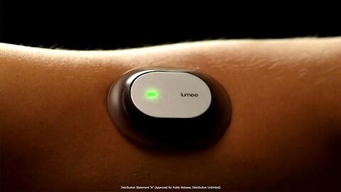 "Revolutionizing Health Monitoring with Profusa Implantable Biosensors: An Overview"