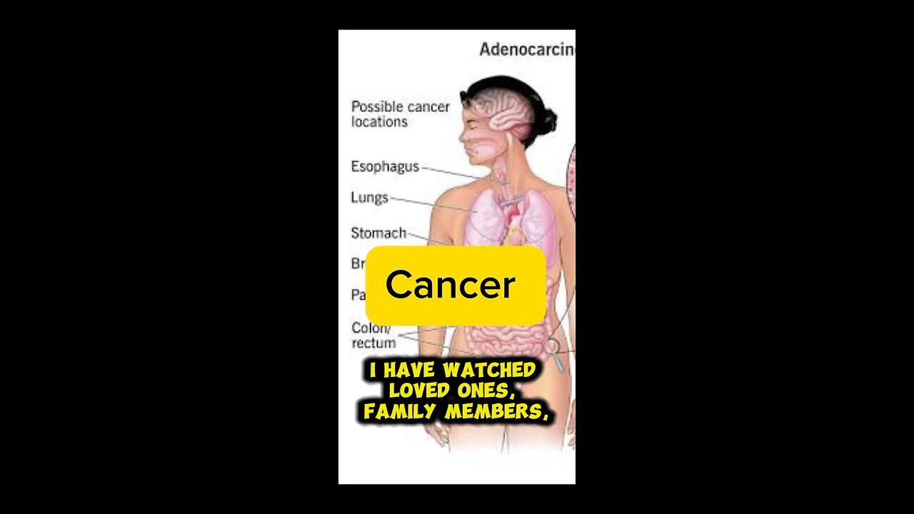 Cancer and parasites