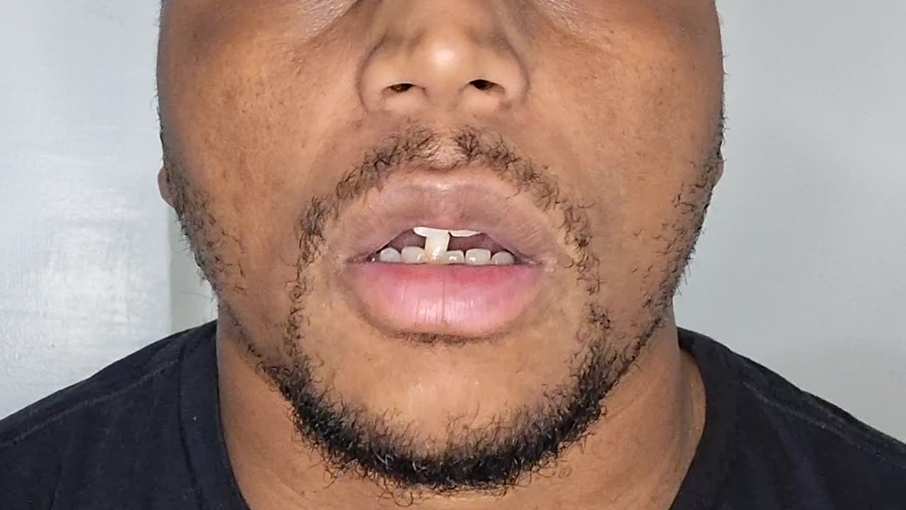 What is a deload week and how to use it ?