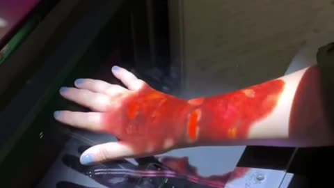 This Snake bite simulator shows the potential effects from a bite