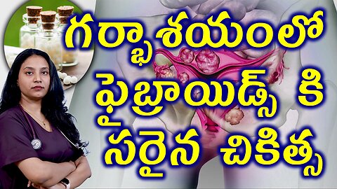 గర్భాశయంలో ఫైబ్రాయిడ్స్ కి సరైన చికిత్స Best HomeopathyTreatment for Infertility Due to Fibroids