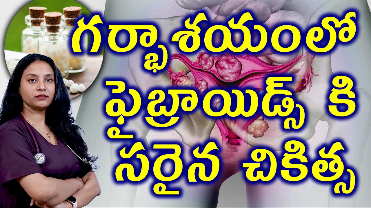 గర్భాశయంలో ఫైబ్రాయిడ్స్ కి సరైన చికిత్స Best HomeopathyTreatment for Infertility Due to Fibroids