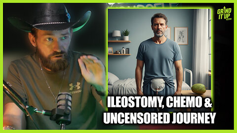 Stage 4 Cancer Battle: Ileostomy, Chemo & Uncensored Journey | Grind It Up Podcast