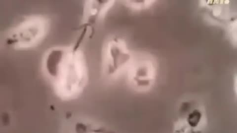 Fluoride at a microscopic level