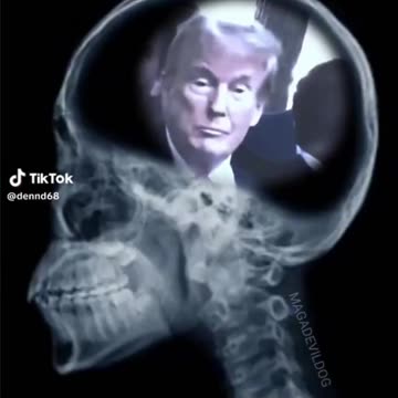 X-ray of a liberal TDS Rent Free