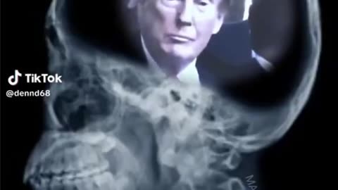 X-ray of a liberal TDS Rent Free