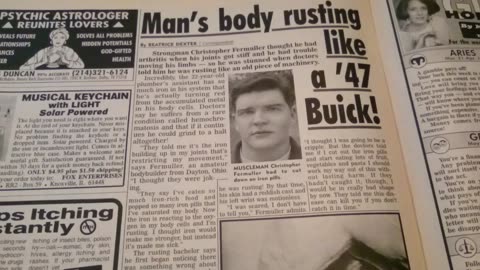 Ep.7 You Won't Believe This Man Is Rusting From The Inside Out