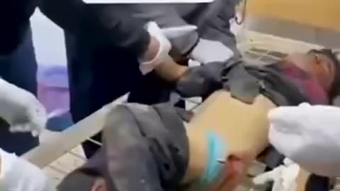 🔥💥🤬💣🔥 The Israelis are using food as bait to slaughter innocent kids...🤬