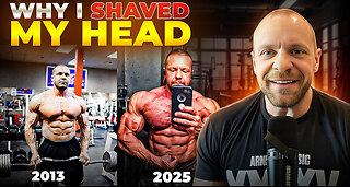 Why I Shaved My Head