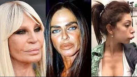 Plastic surgery gone wrong (CARNAL MINDS/VANITY)