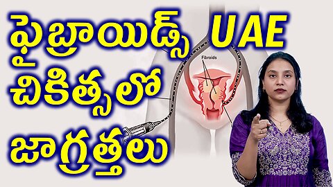 ఫైబ్రాయిడ్స్ UAE చికిత్సలో జాగ్రత్తలుPrecautions for Fibroids Uterine Artery Blocking Embolization