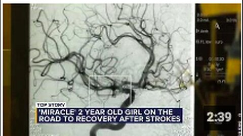 "Two-Year-Old Suffers Multiple Strokes Caused by Blood Clot"