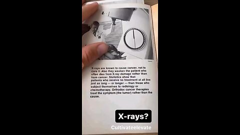 X RAYS ARE KNOWN TO CAUSE CANCER - ALSO THEY WEAKEN THE PATIENTS - CANCER IS PARASITES!!!