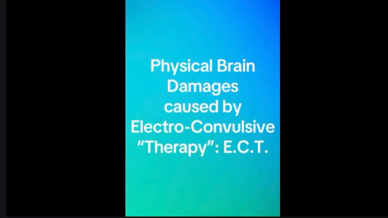 Electro-Convulsive “Therapy”