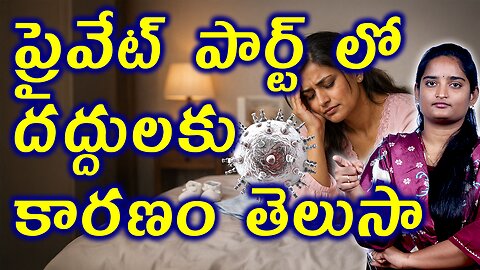 ప్రైవేట్ పార్ట్ లో దద్దులకు కారణం Causes For Genital Herpes | Herpes Infection Homeopathy Medicine