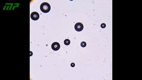 Analyse au microscope optique du vaccin contre la rougeole