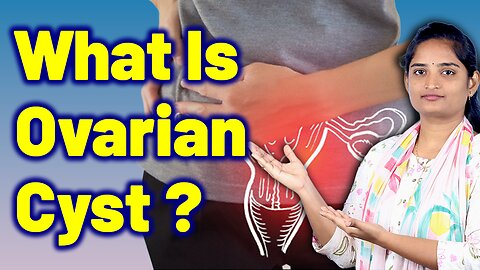 What Is Ovarian Cyst, Hemorrhagic Ovarian Cyst, Ovarian Swelling | Homeopathy, Medicine Treatment