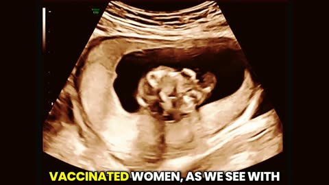 Impact of COVID-19 mRNA vaccines on fertility is under scrutiny.