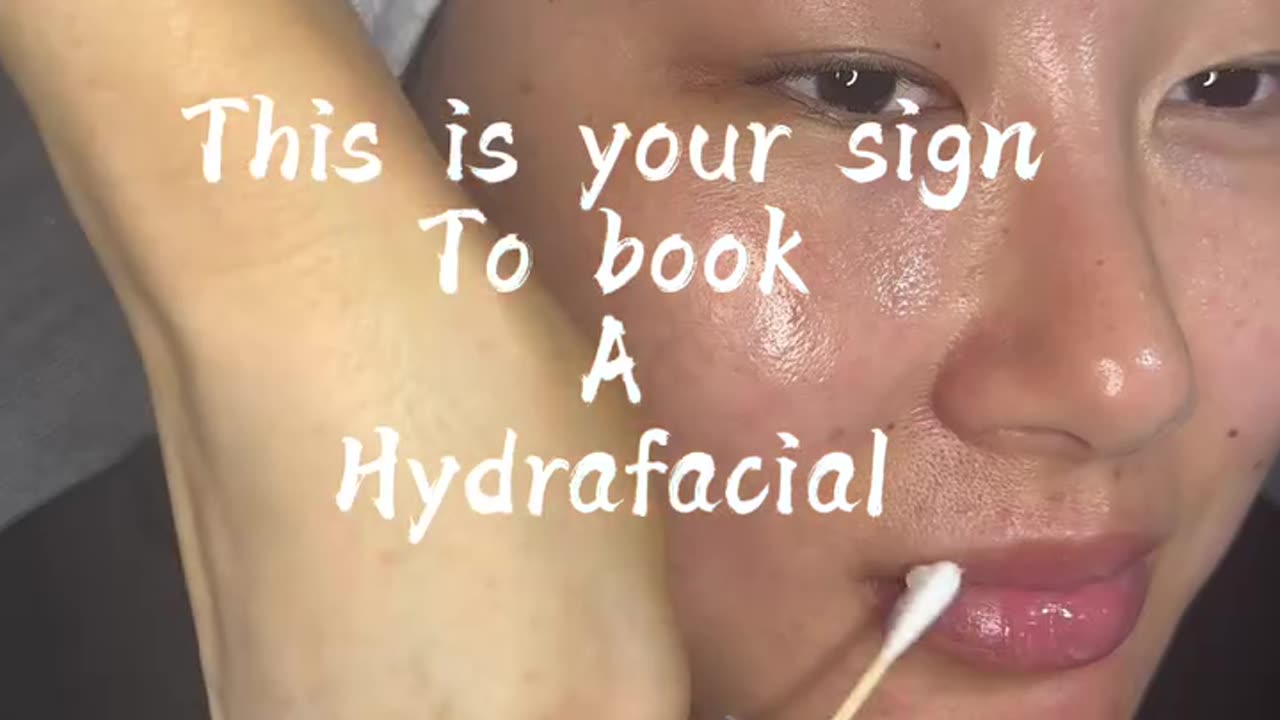 Summer Facial Must-Have: HydraFacial for Oily, Dry & Sensitive Skin 🌞💆‍♀️