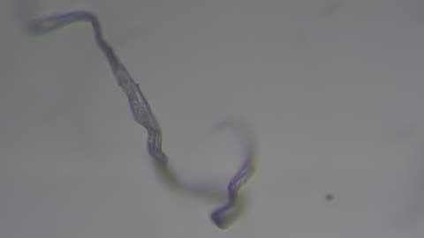 Otomycosis