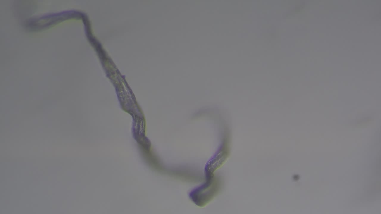 Otomycosis