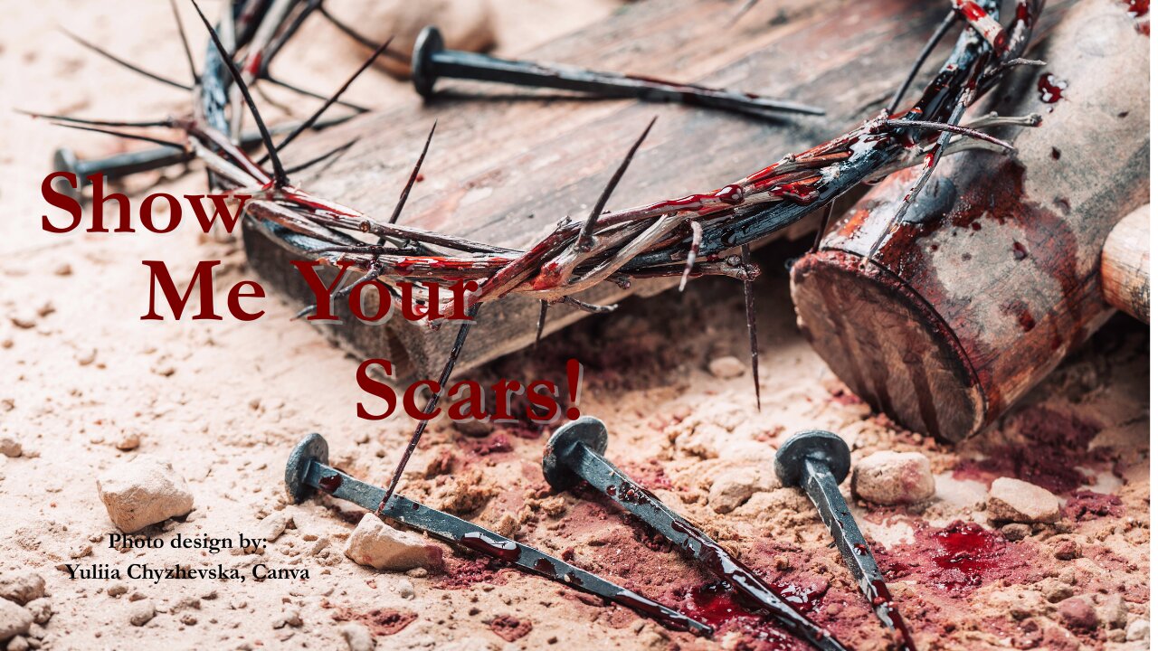 Show Me Your Scars | John 20:19-29