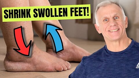 Best Remedies for Swollen Feet