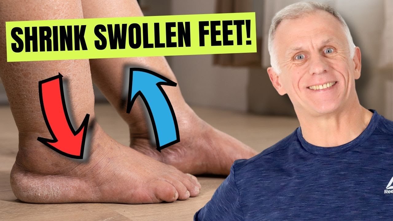 Best Remedies for Swollen Feet