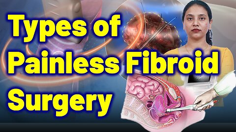 Different Types of Painless Fibroid Surgeries| Laparoscopic, Transvaginal, Ultrasound| Gynaecology