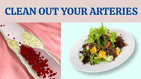 The Best Meals to Unclog Your Arteries – Eat These for a Healthier Heart! HR13