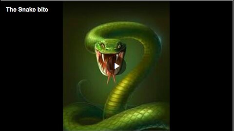 "Understanding Snake Bites: Causes, Symptoms and Treatment"