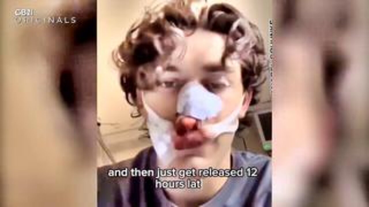 SHOCK in Germany: Hero Tourist Stabbed while Protecting Woman from Muslim Later 'RELEASED by Police'