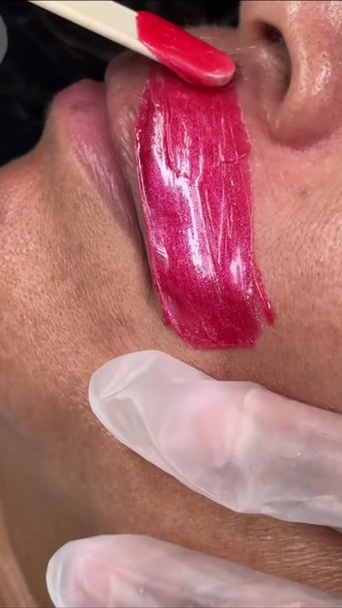 Upper Lip Waxing Using Sexy Smooth Cherry Desire Hard Wax by @lashedwithlana