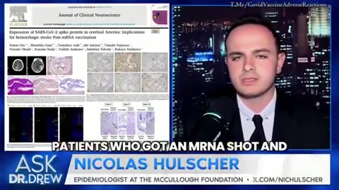 mRNA Spiked Cerebral Arteries Now Proven To Be Attacked By Immune System of Stroke Victims