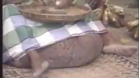 pajeet's enlarged testicles