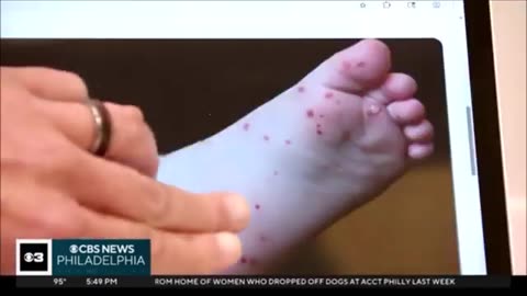 More Plagues Pestilences Continuing To Spread (Bible Prophesy Quietly Speaking)