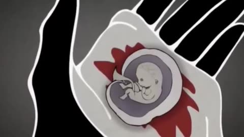 This is what "reproductive freedom" looks like--RU486 #kamalaharris #election2024