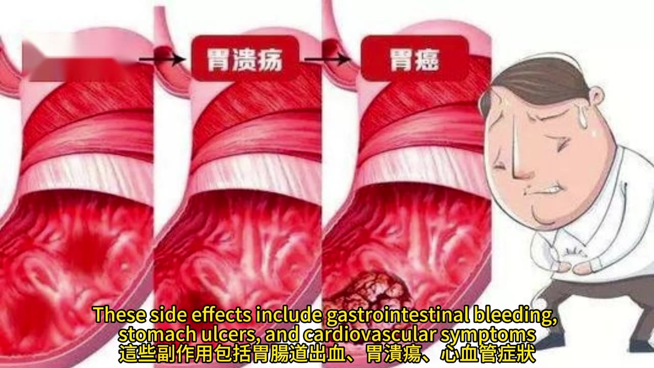 止痛藥 降低痴呆症風險