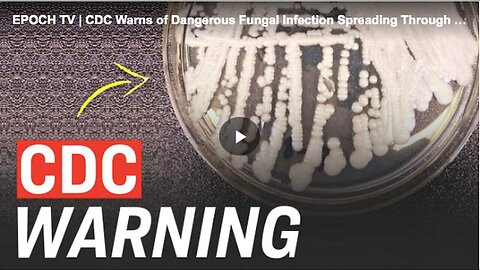 "Alarming Spread of Dangerous Fungal Infections Across America, Warns CDC"